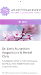 Mobile Screenshot of acuception.com